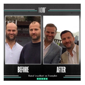Hair transplant from NOW Cosmetics